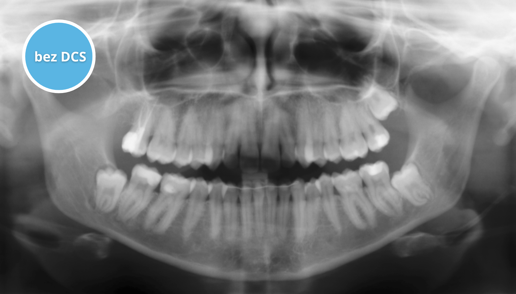Radiografia Cyfrowa Bezpośrednia i Pośrednia – jaki system wybrać?