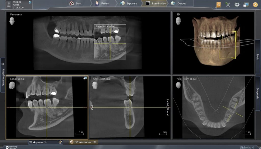 Wybór tomografu stomatologicznego
