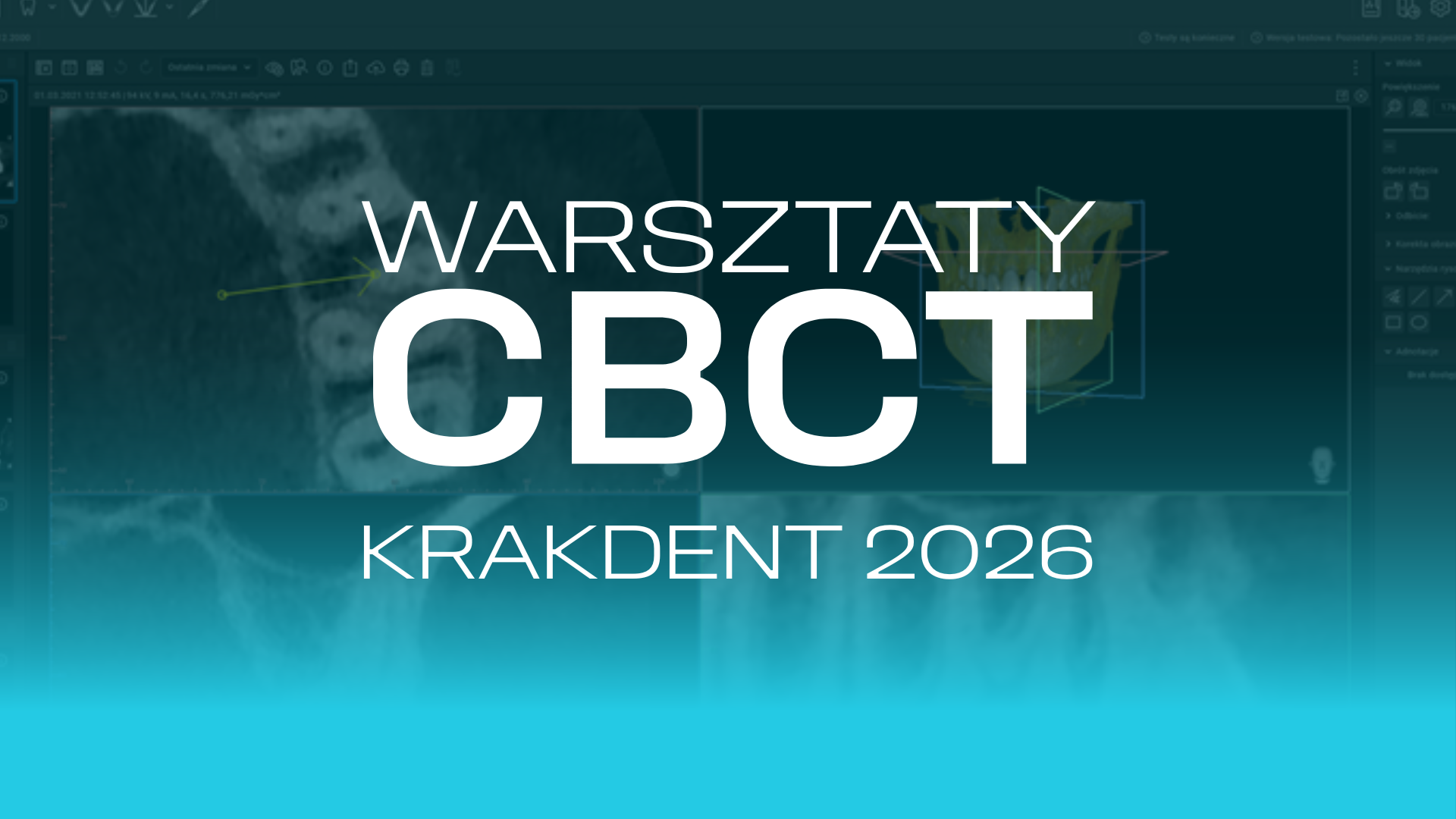 Warsztaty CBCT
